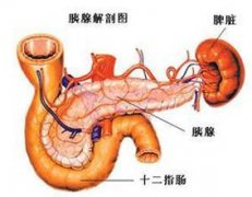 慢性胰腺炎治療方法