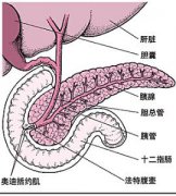 胰島素瘤治療方法