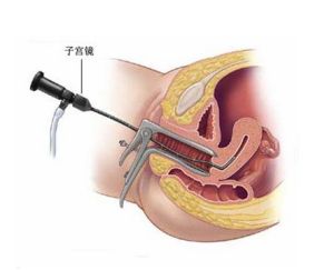 特色診療技術(shù)—腹腔鏡　宮腔鏡